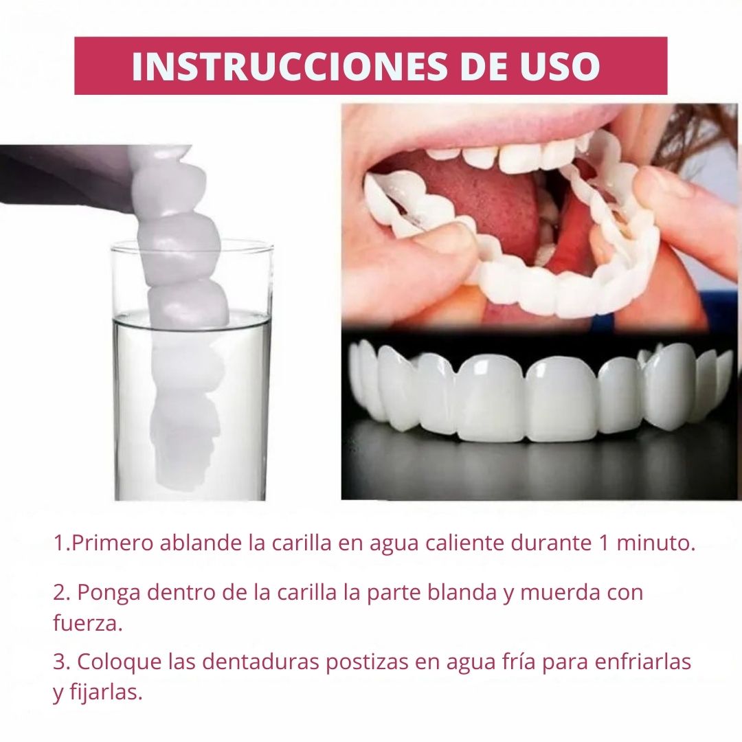 Carillas Dentales Snap-On Smile – Sonrisa Más Atractiva al Instante