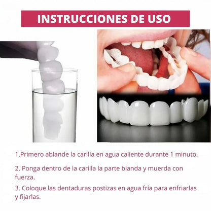 Carillas Dentales Snap-On Smile – Sonrisa Más Atractiva al Instante