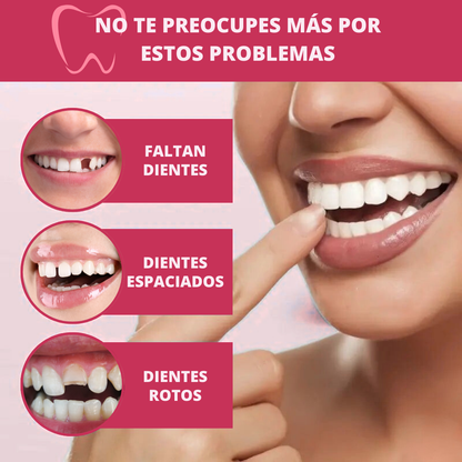 Carillas Dentales Snap-On Smile – Sonrisa Más Atractiva al Instante
