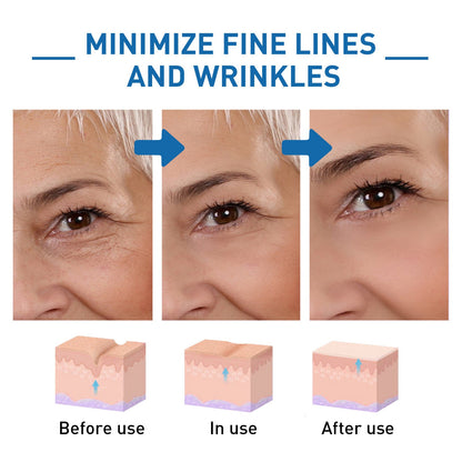 Serum Efecto Botox con Acido Hialurónico